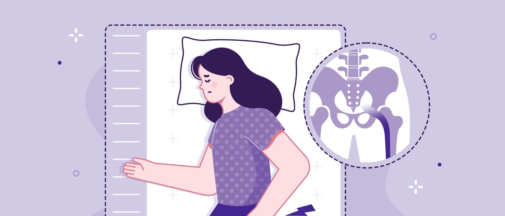 woman laying on mattress with sciatica pain
